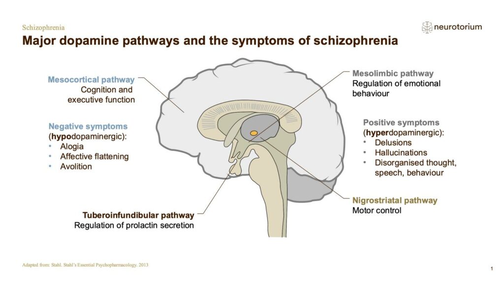 Schizophrenia - Neurobiology and Aetiology - slide 26